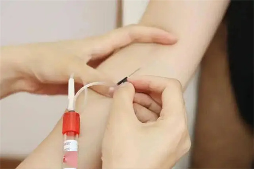图片细节说明